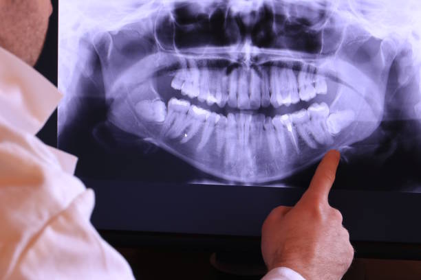 Best Emergency Treatment for Dental Infections or Abscesses in Lakeside Park, KY